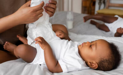 troca de fralda em bebe para representar alergia a fralda