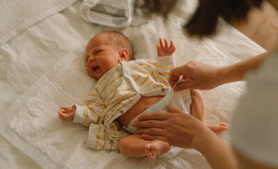Aprenda como evitar assaduras no bebê